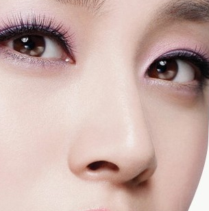 隆鼻多长时间可以恢复,隆鼻恢复过程记录图片