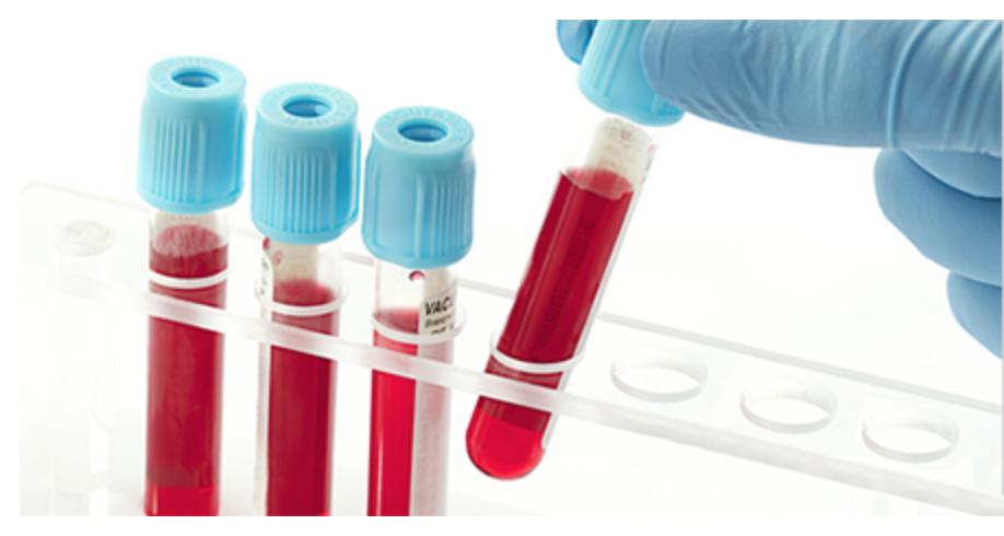 最新前沿治疗肿瘤技术,液体活检癌症筛查