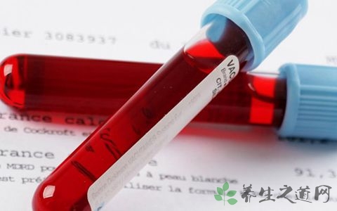 怎么查血糖高不高,怎么查血糖去医院