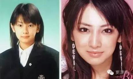 日本整形与韩国整形对比,为什么日本整形不如韩国整形