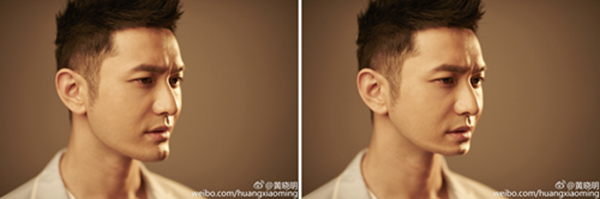 彭于晏下巴怎么这么长,彭于晏下巴有整吗