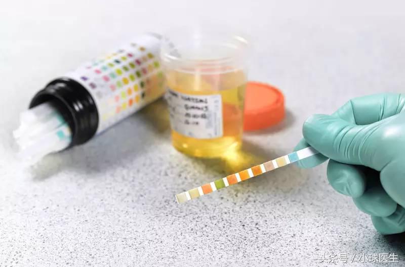 如何留取尿液标本，看了就知道！
