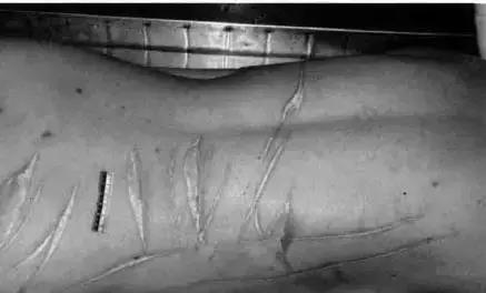 慈禧太后死后诈尸是真的吗,死后诈尸怎么回事