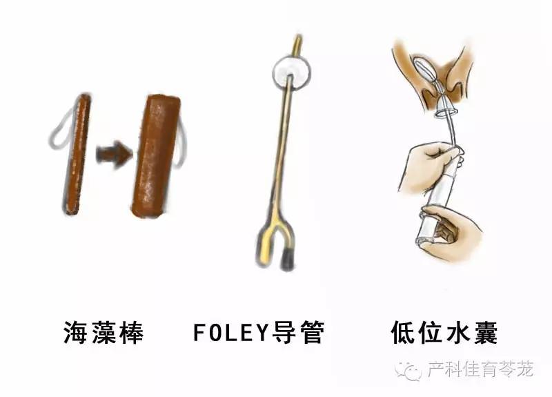 到日子了不生咋办?爬楼梯,吃辣椒...靠谱吗?