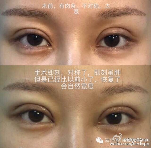 滕雨佳林珊珊谁混得好,滕雨佳林珊珊视频