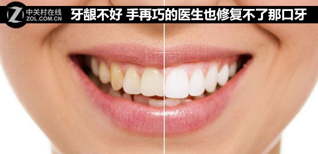 牙龈牙齿不好怎么办,牙龈不好用什么药恢复得好