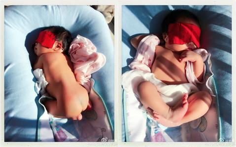 中老年晒太阳的注意事项,宝宝黄疸晒太阳注意什么