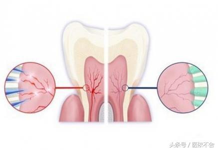 遇到冷、热、牙齿敏感酸痛该怎么办？