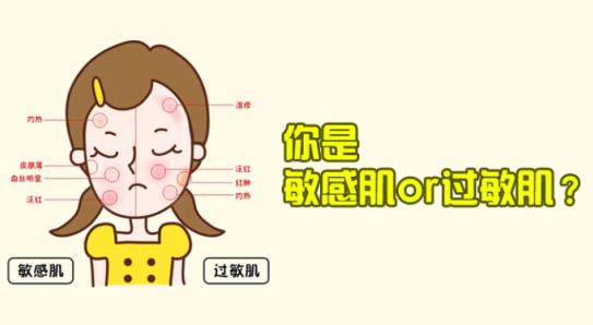 寒风吹了脸红肿怎么办,寒风吹到脸上很痛怎么回事