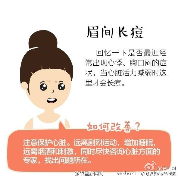 大学生因挤痘引发的一连串事情,挤青春痘导致颅内感染死亡