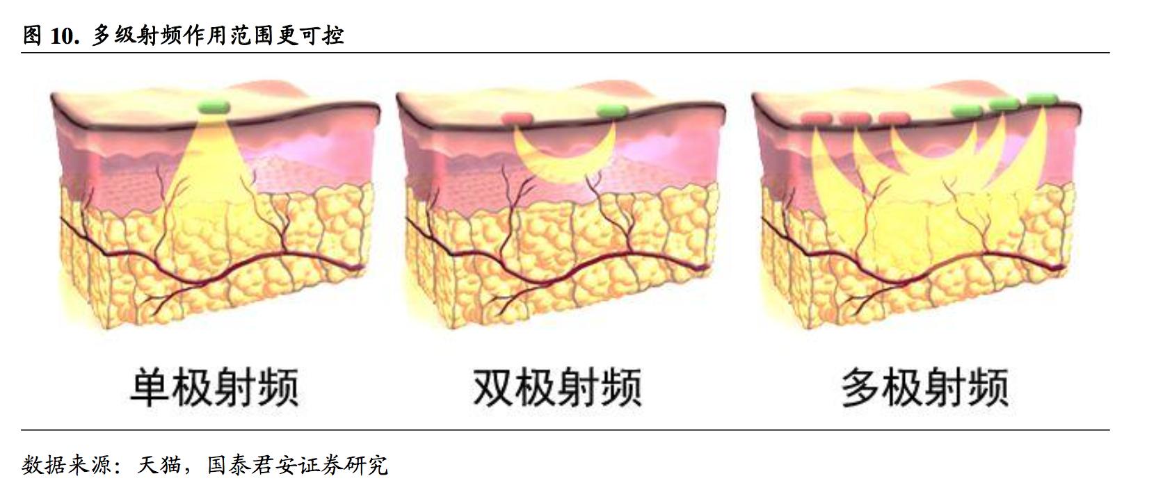 什么仪器和产品祛皱美白,用什么美容仪去皱效果最好用