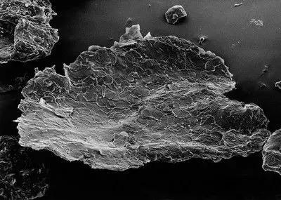 洗头过后头皮干燥大量头皮屑,头皮屑多应该多洗头还是少洗