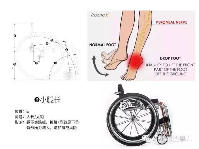 轮椅可量身订制吗,定制型轮椅