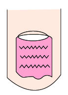 指甲出现白点、纵纹是怎么回事?