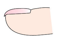 指甲出现白点与竖纹是怎么回事,指甲出现白点什么原因