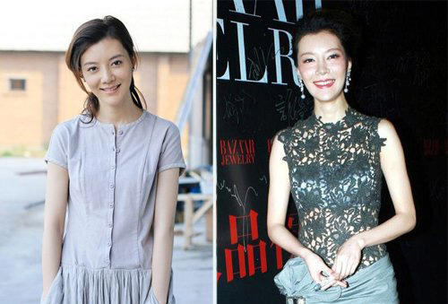 高调嫁首富，分手获三亿补偿，如今整容失败吓坏众人