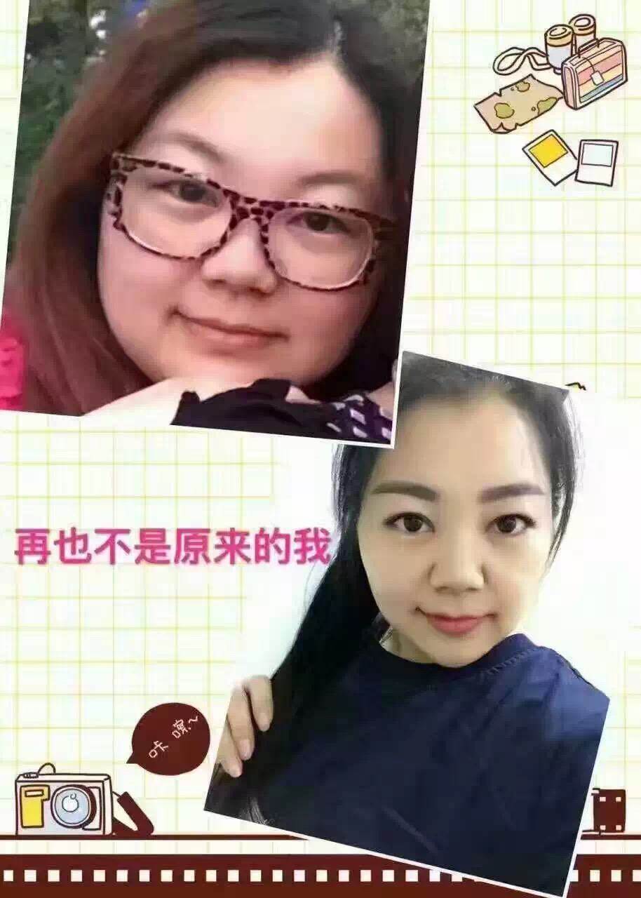 真实有效的减肥方式,放血疗法可以减肥吗