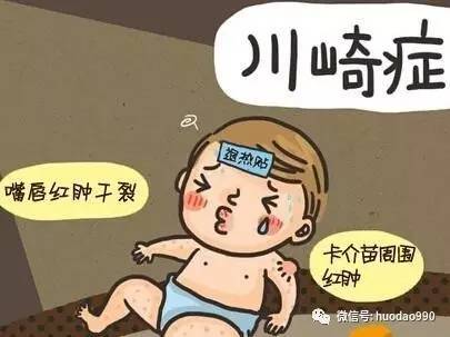 孩子高烧不退当心川崎病,孩子高烧不退当心得了川崎病