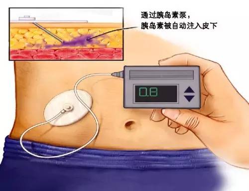 “辟谷”为何致人死亡？“辟谷”到底科学不科学？
