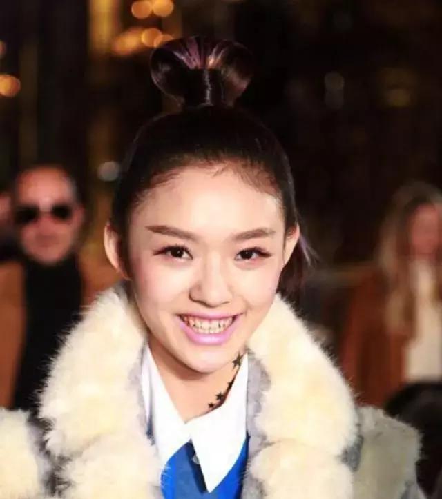 林允的牙怎么又恢复了,林允回应脸型变化她又变脸了吗