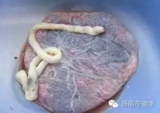 胎盘不存在微生物是什么意思,如何确定胎盘有活性
