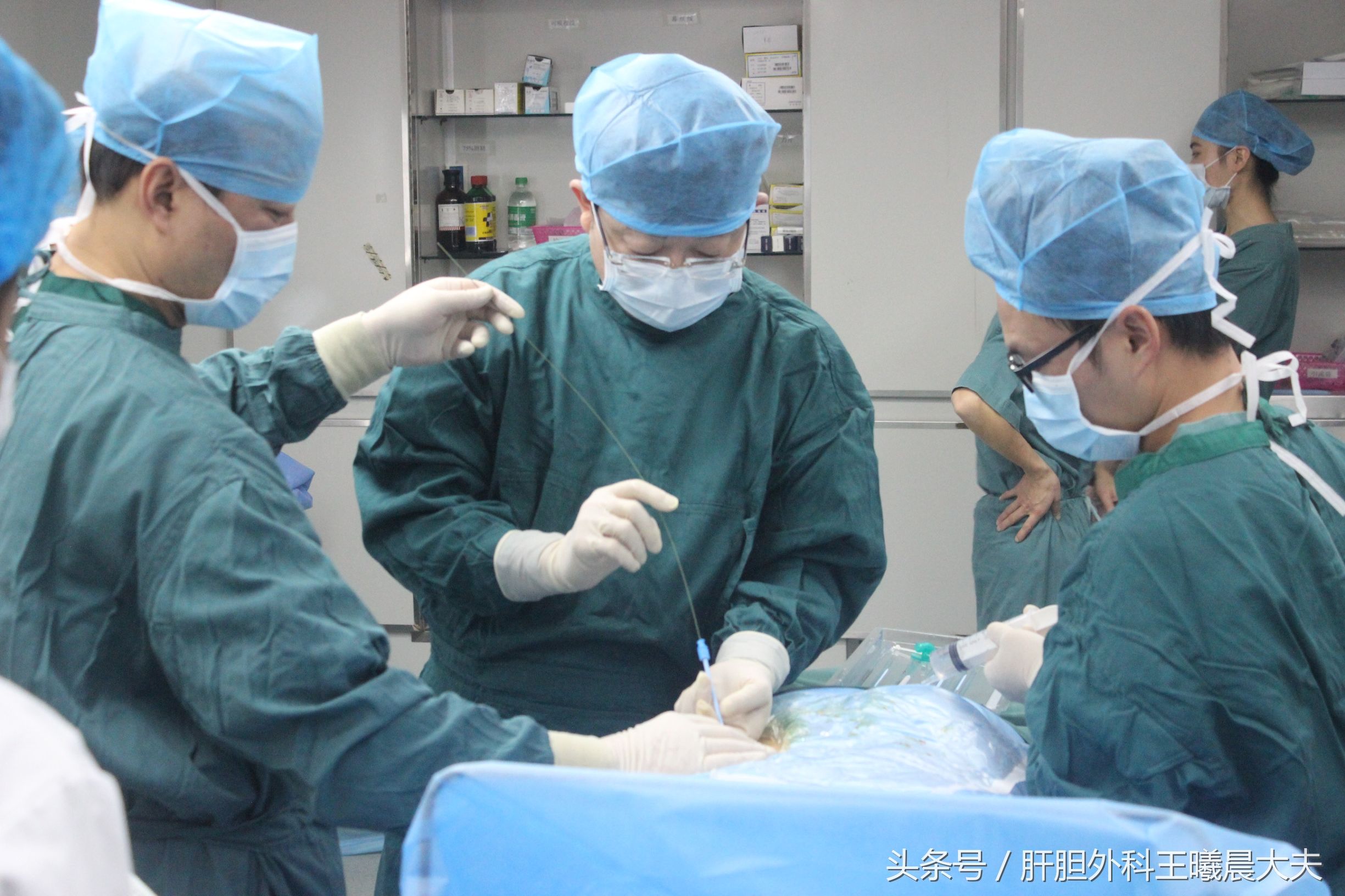 微创取结石插管得多久,微创结石取管