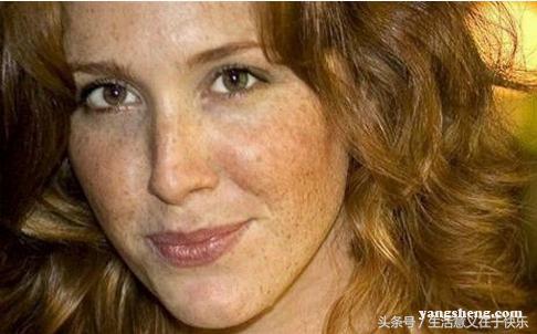 皮肤癌患者早期都有哪些症状,皮肤癌有哪些症状和表现