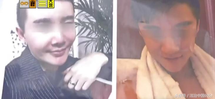 打3年瘦脸针现在方脸变瓜子脸,瘦脸针怎么让脸变瘦的