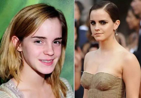 编辑朋友圈｜卸妆不彻底，2万块的精华都救不了你的脸！