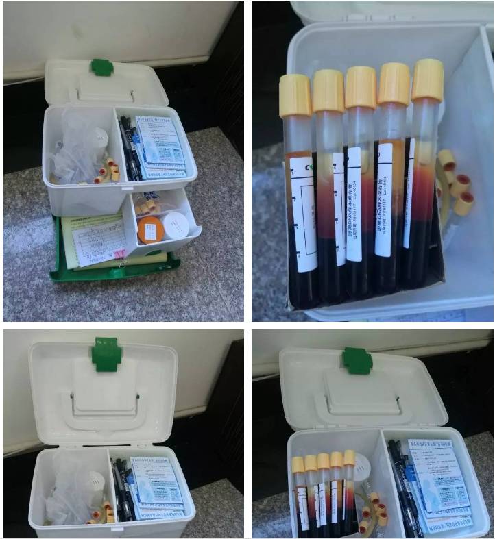 浜у墠绛涙煡nipt鍜宯t蹇呴』閮借鍋氬悧,nipt鍙岃儙浜у墠绛涙煡