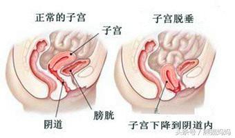 分娩前见红是什么症状,分娩前见红一般多久生