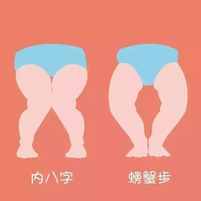 宝宝学步期应该注意什么,婴儿走姿怎么矫正