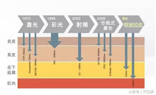 超声刀值得做吗 (超声刀怎么样啊)