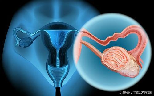 初期宫颈癌可能出现的三大症状,宫颈癌早期10种症状无药可救了