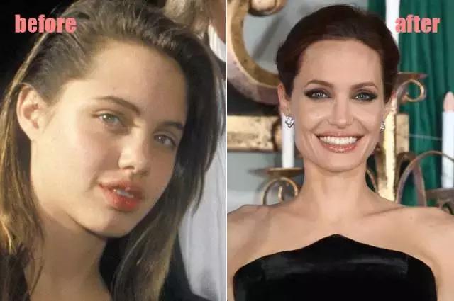 整牙=整容?看杨幂、刘涛、高圆圆为你亲身示范!