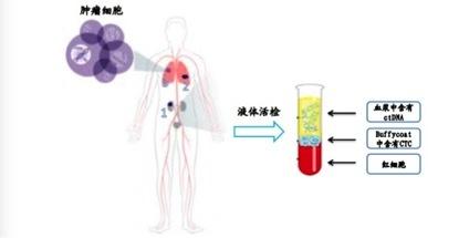 索真基因检测样本采集盒,索真基因检测是什么