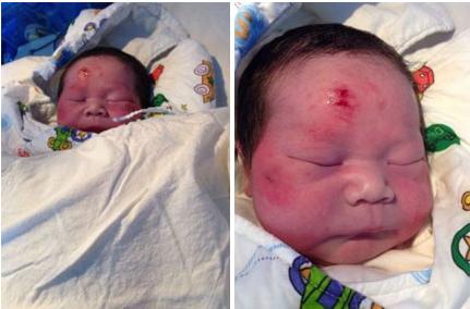 孕妇被车撞腹中胎儿要求补偿,车祸伤到孕妇胎儿怎么赔偿