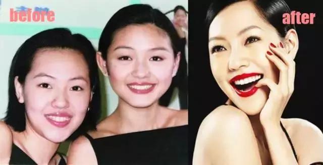 整牙=整容?看杨幂、刘涛、高圆圆为你亲身示范!