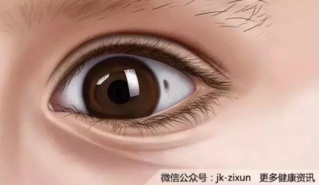 眼白上有黑点是怎么回事,眼白上的黑斑有影响吗
