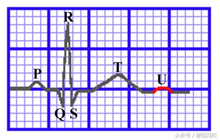 郭雅卿零基础心电图教学口诀,郭老师教你心电图口诀