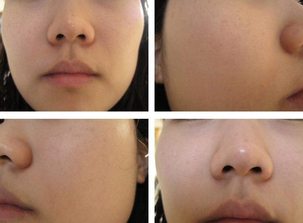 雪花秀玉容撕拉面膜搭配,雪花秀玉容撕拉面膜评测