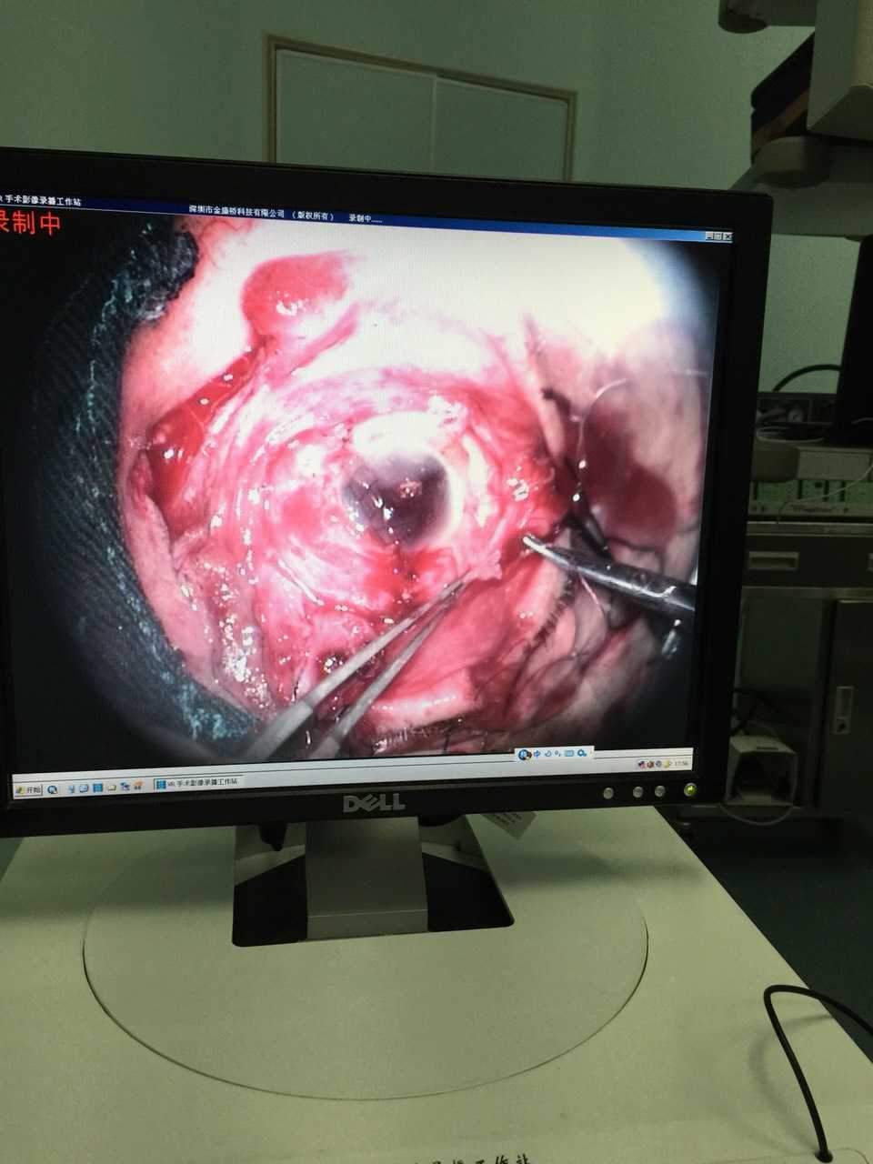 解放军306医院除夕之夜倒计时与正计时