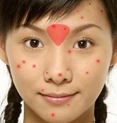 脸上长痘痘是什么原因一碰就疼,脸上长痘痘是什么原因怎么解决