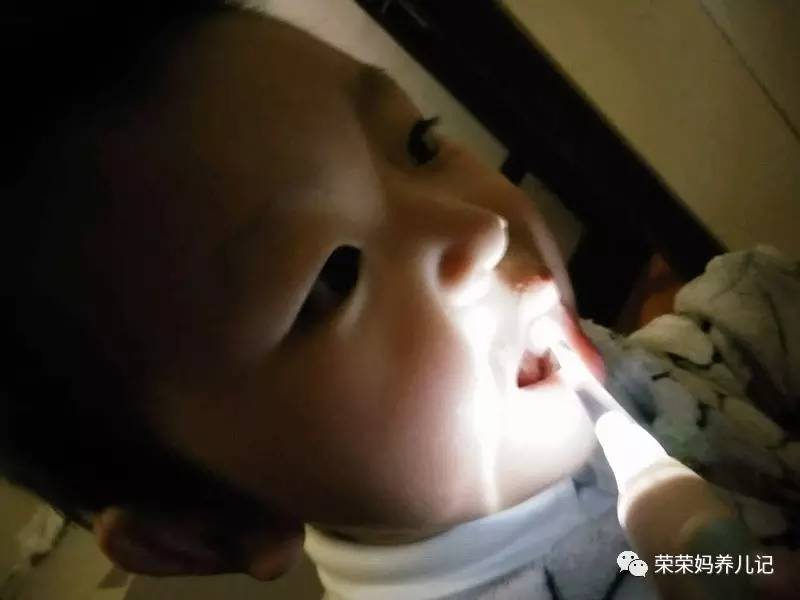 盘点李*荣大**的牙刷军团！其实吧，牙刷并不是重点，怎么刷才是！