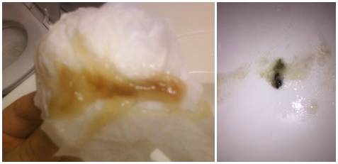 宝宝清鼻涕变黄鼻涕鼻塞好方法,清鼻涕的正确方法图片