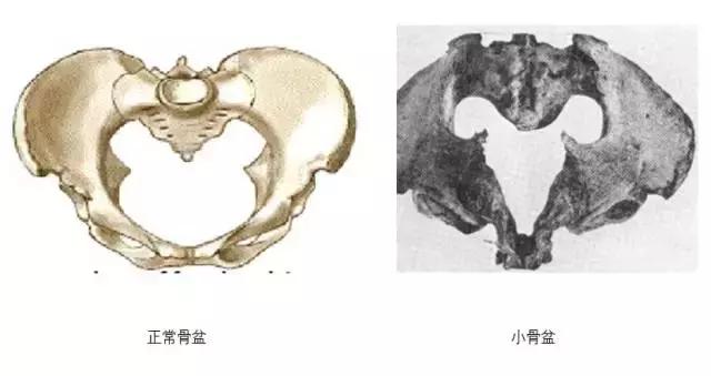 怀孕了只吃叶酸足够吗,叶酸和维生素d缺乏影响怀孕吗
