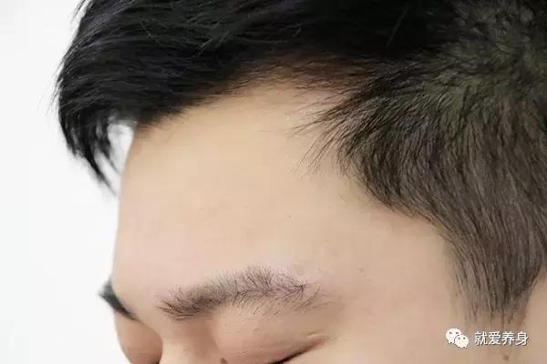 中医腋下出汗多是什么原因引起的,这几个部位出汗你可要当心了