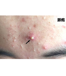 刘歪歪脱骨凤爪凉拌菜,刘歪歪的作品原声