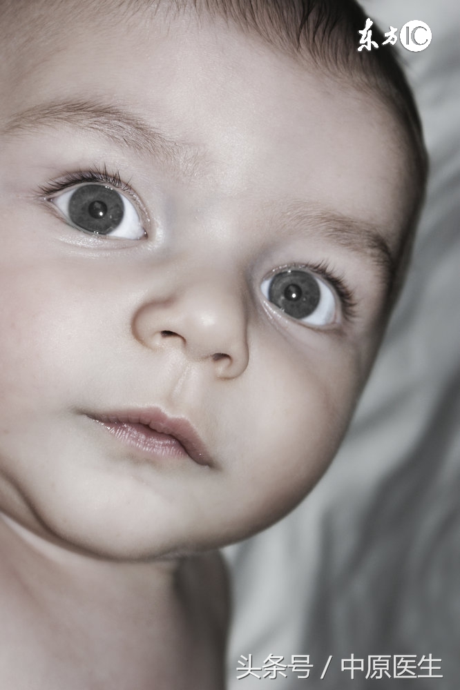 发现自己好像得了斜视怎么办,有轻微的斜视怎么办