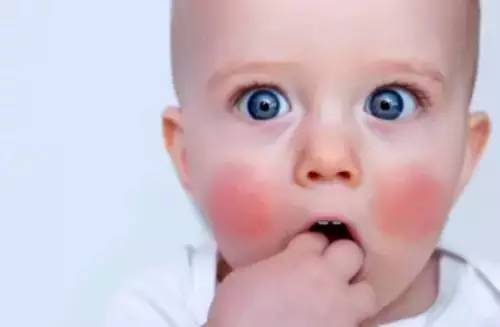 三岁宝宝上火眼屎多喝什么降火,宝宝上火眼屎多怎么推拿